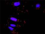 ELK1 Antibody in Proximity Ligation Assay (PLA) (PLA)