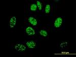 ELK4 Antibody in Immunocytochemistry (ICC/IF)