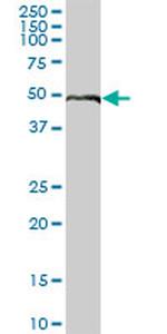 ELK4 Antibody in Western Blot (WB)