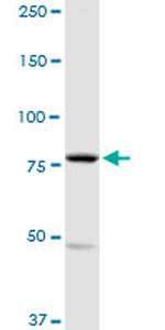 MARK2 Antibody in Western Blot (WB)