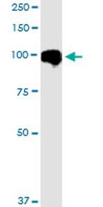 MARK2 Antibody in Western Blot (WB)