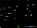 MARK2 Antibody in Immunocytochemistry (ICC/IF)