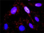 CTTN Antibody in Proximity Ligation Assay (PLA) (PLA)