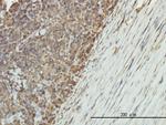 ENO1 Antibody in Immunohistochemistry (Paraffin) (IHC (P))