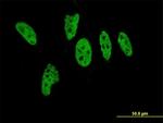 EP300 Antibody in Immunocytochemistry (ICC/IF)