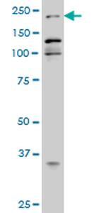 EP300 Antibody in Western Blot (WB)