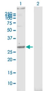 STOM Antibody in Western Blot (WB)