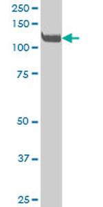 EPHA3 Antibody in Western Blot (WB)