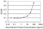 EPHB2 Antibody in ELISA (ELISA)