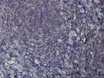 EPHB3 Antibody in Immunohistochemistry (Paraffin) (IHC (P))