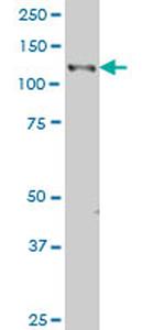 EPHB3 Antibody in Western Blot (WB)