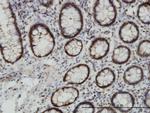 EPHB3 Antibody in Immunohistochemistry (Paraffin) (IHC (P))