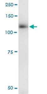 EPHB3 Antibody in Immunoprecipitation (IP)