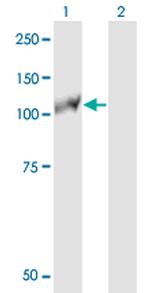 EPHB3 Antibody in Western Blot (WB)