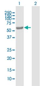 EPHX2 Antibody in Western Blot (WB)