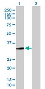 STX2 Antibody in Western Blot (WB)