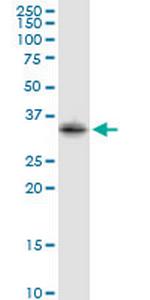 STX2 Antibody in Western Blot (WB)