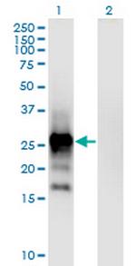 EPO Antibody in Western Blot (WB)