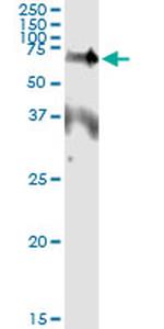 EPOR Antibody in Immunoprecipitation (IP)