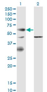 EPOR Antibody in Western Blot (WB)