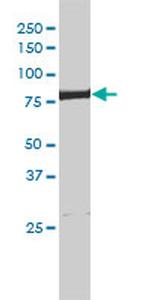 ERCC2 Antibody in Western Blot (WB)