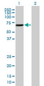 ETS2 Antibody in Western Blot (WB)