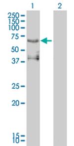 ETV4 Antibody in Western Blot (WB)