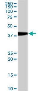 EVX1 Antibody in Western Blot (WB)