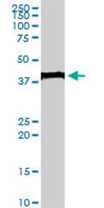 EVX1 Antibody in Western Blot (WB)