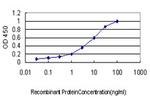 EXT2 Antibody in ELISA (ELISA)