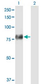 F2 Antibody in Western Blot (WB)