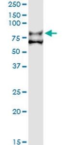 F11 Antibody in Immunoprecipitation (IP)