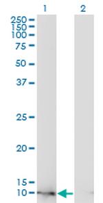 FABP4 Antibody in Western Blot (WB)