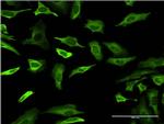 FABP4 Antibody in Immunocytochemistry (ICC/IF)