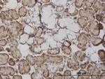 FABP4 Antibody in Immunohistochemistry (Paraffin) (IHC (P))