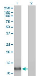 FABP4 Antibody in Western Blot (WB)