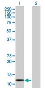 FABP6 Antibody in Western Blot (WB)