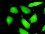 PTK2B Antibody in Immunocytochemistry (ICC/IF)