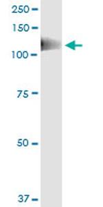 PTK2B Antibody in Immunoprecipitation (IP)