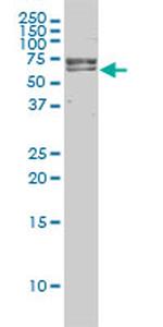 FANCG Antibody in Western Blot (WB)