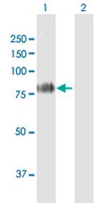 FBLN1 Antibody in Western Blot (WB)