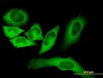 FASN Antibody in Immunocytochemistry (ICC/IF)