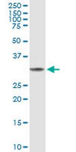 FBP1 Antibody in Western Blot (WB)