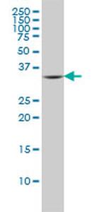 FCER1A Antibody in Western Blot (WB)