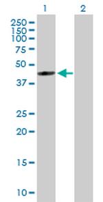 FDFT1 Antibody in Western Blot (WB)