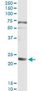 FGA Antibody in Immunoprecipitation (IP)