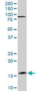 FGF1 Antibody in Western Blot (WB)