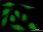 FGF1 Antibody in Immunocytochemistry (ICC/IF)