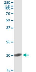 FGF1 Antibody in Immunoprecipitation (IP)