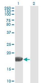 FGF1 Antibody in Western Blot (WB)